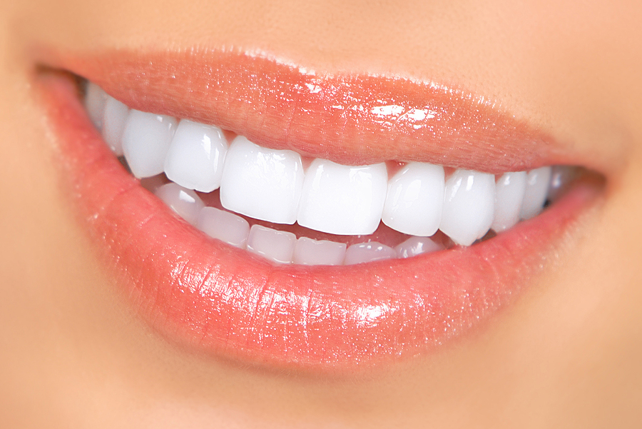 Things You Should Know About Dental Implants