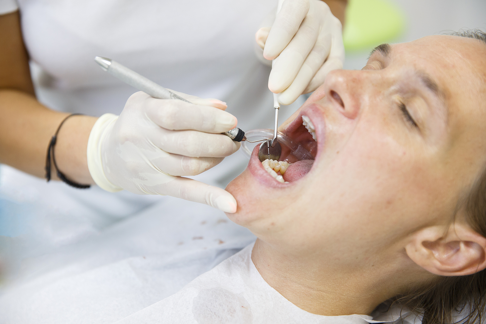 Essential Tips for a Smooth Recovery After a Root Canal Procedure